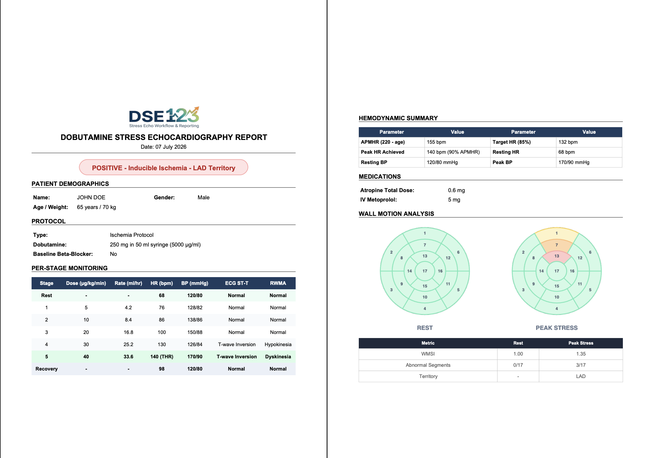 Full sample dobutamine stress echocardiography report generated by DSE123